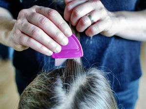 Dari Mana Munculnya Kutu Rambut pada Manusia? Dari Mana Munculnya Kutu Rambut pada Manusia?