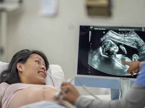 A pregnant female of Asian decent, lays out on an exam table as a technician conducts her ultrasound.  She is dressed casually and has her belly exposed as she looks to the screen to see her baby.
