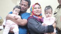 Berhasil Dipisahkan, Bayi Kembar Siam di Malang Akhirnya Pulang