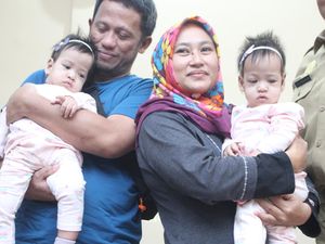 Berhasil Dipisahkan, Bayi Kembar Siam di Malang Akhirnya Pulang Berhasil Dipisahkan, Bayi Kembar Siam di Malang Akhirnya Pulang
