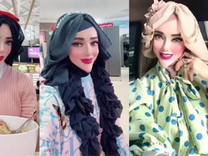 Kata Dermatolog soal Filler, Dijajal PNS Yuni Jasmine demi Dagu Lancip Kata Dermatolog soal Filler, Dijajal PNS Yuni Jasmine demi Dagu Lancip