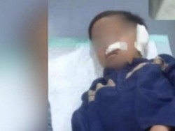 Telinga Bocah Pasuruan Putus Digigit Teman Saat Ditinggal Guru Ngaji Salat