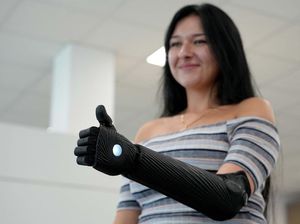 Melihat Kecanggihan Lengan Bionik 3D Buatan Inggris