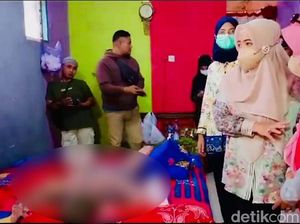 Derita Gadis Belia di Tegal Idap Penyakit SSSS, Sekujur Tubuh Melepuh Derita Gadis Belia di Tegal Idap Penyakit SSSS, Sekujur Tubuh Melepuh