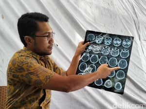 Sekolah Jelaskan Penyebab Siswa Dikeroyok Abang Kelas Usai Pengajian Sekolah Jelaskan Penyebab Siswa Dikeroyok Abang Kelas Usai Pengajian
