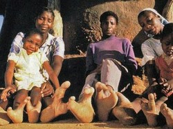 Gegara Kawin Inses, Suku Vadoma Miliki Kaki Mirip Kaki Burung Unta