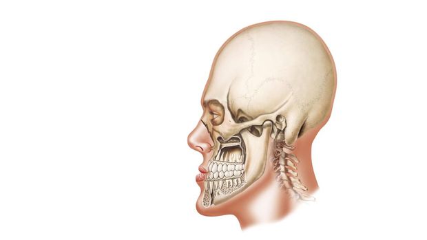 ilustrasi Hasburg Jaw Bone and dental features lateral view in the dolicofacial.