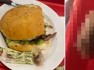 Jijik! 4 Orang Ini Tak Sengaja Temukan Potongan Jari Manusia di Makanan Jijik! 4 Orang Ini Tak Sengaja Temukan Potongan Jari Manusia di Makanan