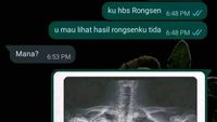 Chat Kocak Nanya Temen, Nggak Ada yang Bener