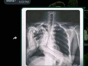 Chat Kocak Nanya Temen, Nggak Ada yang Bener