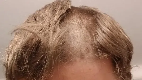 Potret Kesialan yang Dialami Warganet, Bikin Ngelus Dada