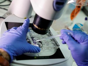 MA Alabama Putuskan Embrio Beku Dianggap Anak MA Alabama Putuskan Embrio Beku Dianggap Anak