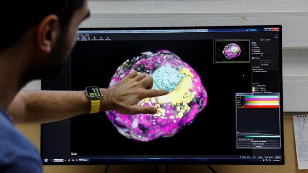 Ilmuwan Israel Buat Embrio Manusia Tanpa Sel Telur dan Sperma