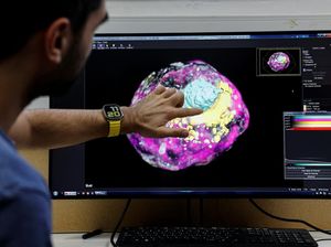 Ilmuwan Israel Buat Embrio Manusia Tanpa Sel Telur dan Sperma