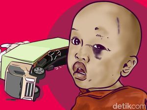 Kondisi Balita Selamat dari Kecelakaan Truk di Lampung, Alami Luka-luka di Wajah