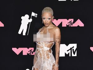 Rilis Lagu Baru, Doja Cat Sindir Kardashian-Jenner yang Gemar Operasi Plastik