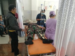 Babinsa di Karangasem Patah Tulang karena Tabrak Truk Saat Kawal Mobil Damkar