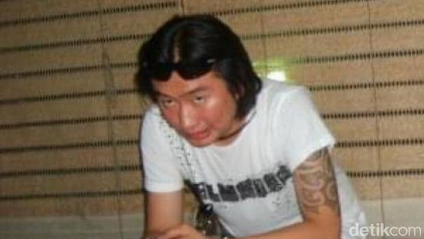 Tampang Fredy Pratama, gembong narkoba, sebelum dan sesudah operasi plastik.