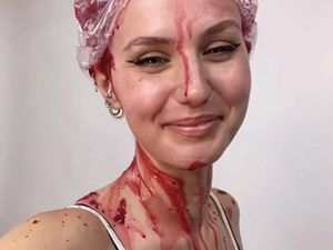 Wanita Ini Ngecat Rambut Pakai Umbi-umbian, Hasilnya Bikin Takjub Wanita Ini Ngecat Rambut Pakai Umbi-umbian, Hasilnya Bikin Takjub