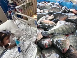 Ngeri! Wanita Ini Hampir Tewas Gegara Makan Ikan Nila