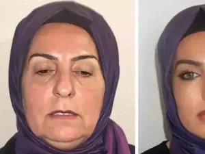 Viral Foto Before After Wanita 68 Tahun Oplas, Bikin Kaget Dikira Beda Orang Viral Foto Before After Wanita 68 Tahun Oplas, Bikin Kaget Dikira Beda Orang