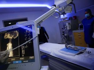 Jasad Alien Dites DNA: Belum Ada Kesamaan dengan Spesies Bumi Jasad Alien Dites DNA: Belum Ada Kesamaan dengan Spesies Bumi