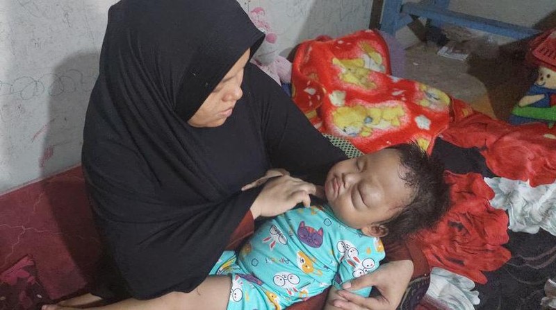 Mari Bantu Arumi, Anak Penjual Bihun Gulung Pengidap Tumor Mata