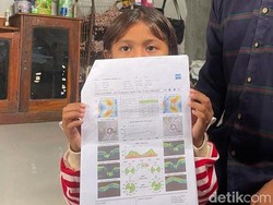 Peliknya Mencari Penyebab Turunnya Penglihatan Mata Siswi SD Gresik