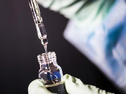 Bukan Hanya Hari Pahlawan, 10 November Juga Peringati Hari Sains Sedunia