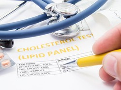 5 Pola Makan Terbaik Untuk Turunkan Kolesterol Tanpa Diet Ketat