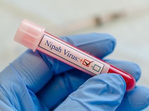 Kemenkes Waspadai Virus Nipah, Pengawasan Pintu Masuk RI Ditingkatkan Kemenkes Waspadai Virus Nipah, Pengawasan Pintu Masuk RI Ditingkatkan
