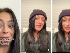 Kisah Wanita Interseks Tak Pernah Haid hingga Punya Testis Internal