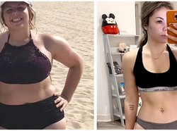 Hanya Minum Air Putih, Wanita Ini Sukses Turun BB 30 Kilogram