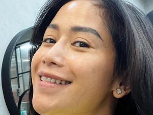 Codeblu Lapor Polisi, Farida Nurhan Nggak Ambil Pusing