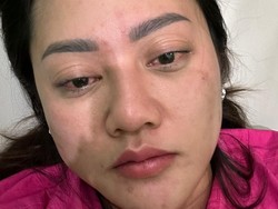 Duduk Perkara Suami Laporkan Dokter Diduga Lakukan Malapraktik ke Istrinya