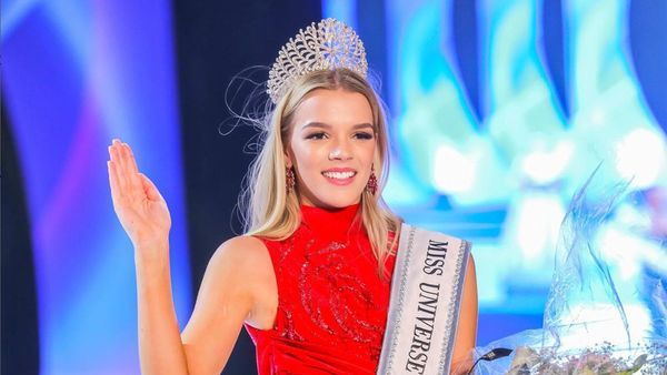 8 Potret Juara Miss Universe Zimbabwe, Jadi Kontroversi karena Berkulit Putih
