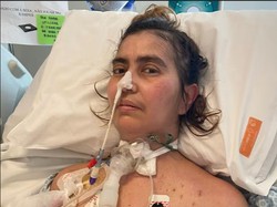 Gegara Makan Saus Pesto, Wanita Ini Lumpuh dan Hampir Kehilangan Nyawa