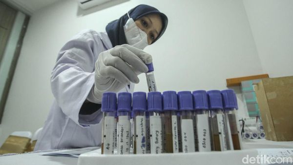 Warga Serbu Pemeriksaan Tiroid Gratis di RSCM