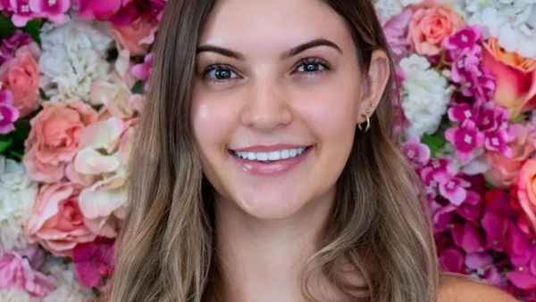 7 Potret Pemenang Kontes Kecantikan Tanpa Makeup, Cantiknya Natural