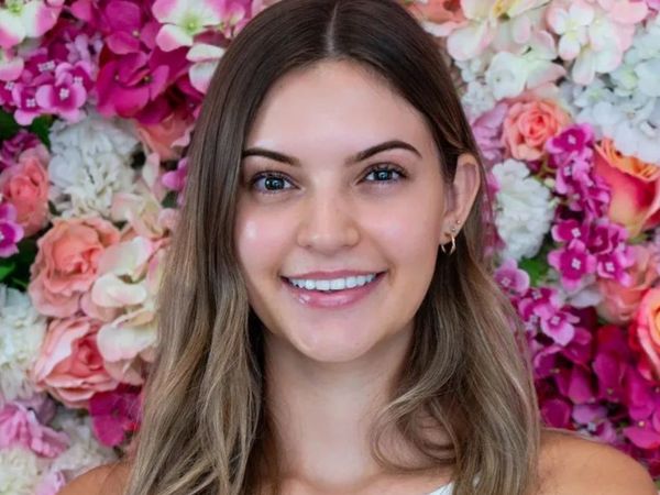 7 Potret Pemenang Kontes Kecantikan Tanpa Makeup, Cantiknya Natural