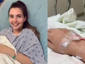 Curhat Wanita Kena Penyakit Langka, Alergi Air Bahkan dengan Keringat Sendiri