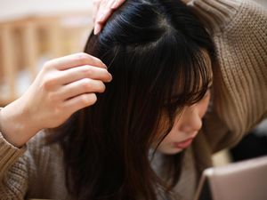 Kondisi Rambut Bisa Jadi Alarm Serius Kesehatan Seseorang, Waspadai Ciri-cirinya Kondisi Rambut Bisa Jadi Alarm Serius Kesehatan Seseorang, Waspadai Ciri-cirinya