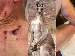 Kanguru Menyerang Lansia Australia Hingga Berdarah dan Celananya Robek