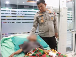Kondisi Terkini Bocah Disetrika Tante di Simalungun