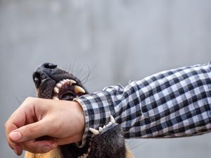 Remaja 13 Tahun Luka Parah Diterkam 5 Anjing Liar di Lombok Tengah Remaja 13 Tahun Luka Parah Diterkam 5 Anjing Liar di Lombok Tengah