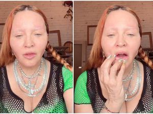 Perubahan Mengejutkan Wajah Madonna, Dokter Menuduhnya 12 Kali Operasi Plastik