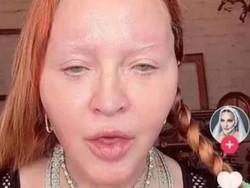 Begini Wajah Madonna Tanpa Filter & Makeup, Disebut Kebanyakan Botox