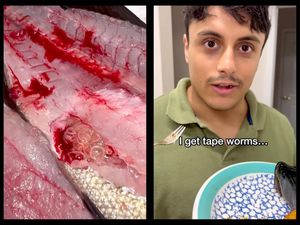 Demi Viral, Pria Ini Makan Ikan yang Mengandung Cacing Pita! Demi Viral, Pria Ini Makan Ikan yang Mengandung Cacing Pita!