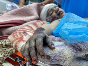 Momen Anak di Gaza Lafalkan Al-Quran saat Dioperasi Tanpa Bius Momen Anak di Gaza Lafalkan Al-Quran saat Dioperasi Tanpa Bius