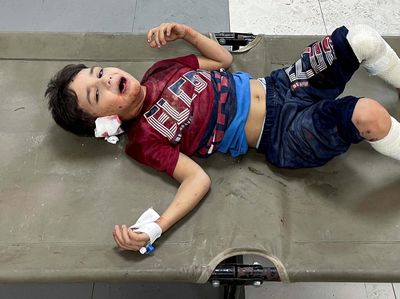 Isak Tangis Anak-anak Palestina Korban Perang Israel Vs Hamas di RS Shifa